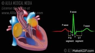 Cardiac Conduction System and Understanding ECG, Animation. on Make a GIF