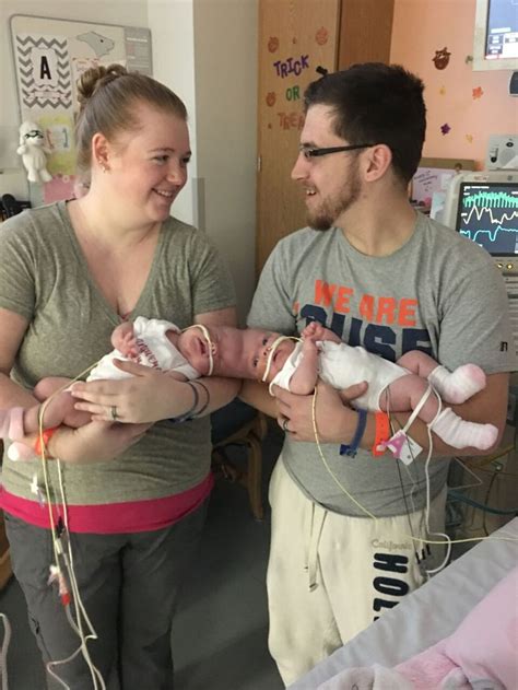 5 Months After Life Changing Surgery, Former Conjoined Twins Are Finally On Their Way Home