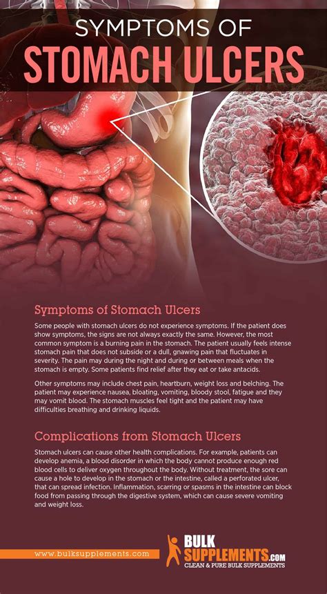 Stomach Ulcers: Causes, Symptoms, Home Remedies & Treatment