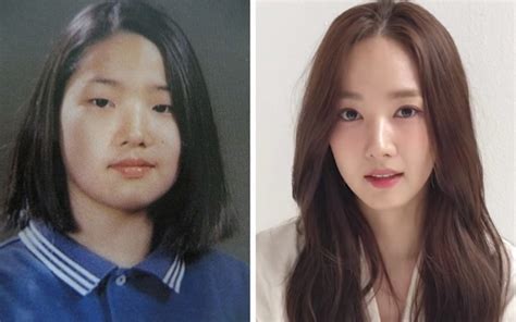 Plastic Surgery Before And After Korean Celebrities - Plastic Industry In The World