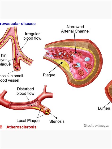 Lumen Anatomy - Anatomical Charts & Posters