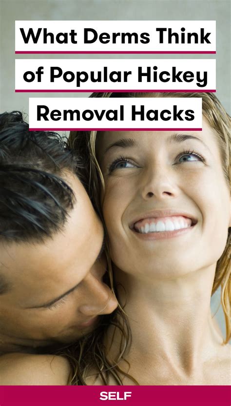 9 of the Most Popular Hickey Removal Hacks—and What Dermatologists Actually Think of Them ...