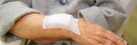 Elderly Skin Bruising: Causes and Prevention