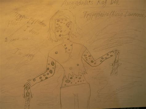 Amygdala's rag doll [Alesa Laurence] by kiki-mimi222222222 on DeviantArt