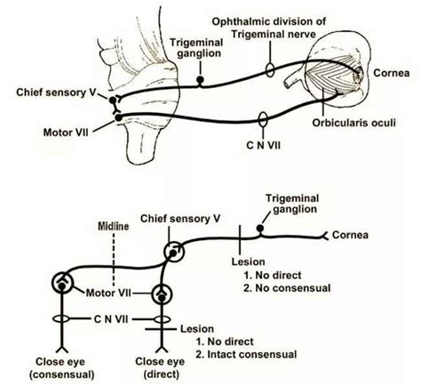 AAOP Corneal Reflex Flashcards | Quizlet