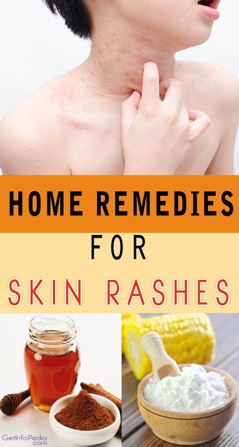 skin irritation remedies