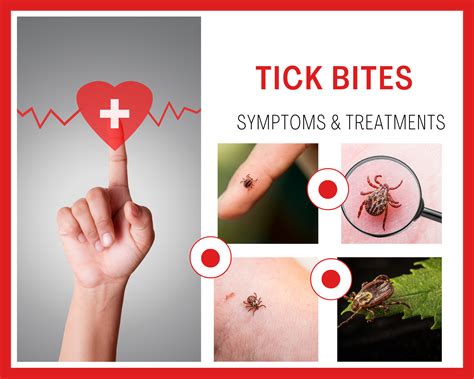 Tick Bites - Symptoms, treatment & prevention