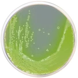 Cetrimide Agar- Composition, Principle, Uses, Preparation, 60% OFF