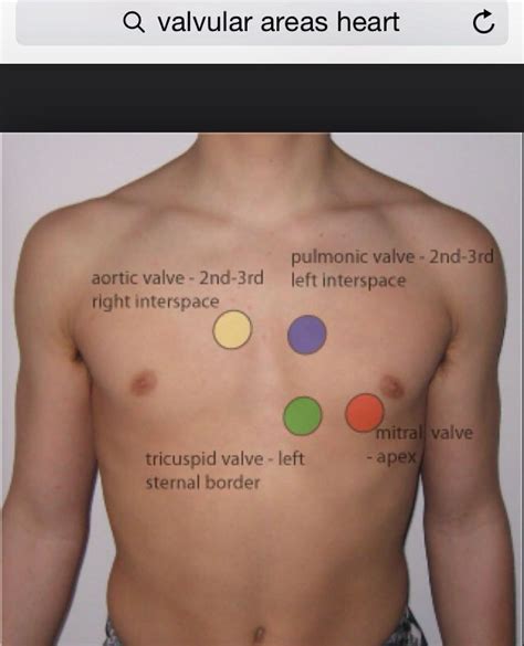 Placement for abnormal heart sounds | Nursing school survival, Nursing ...