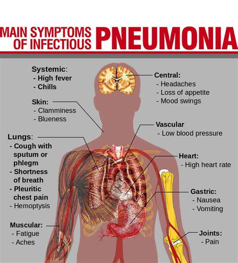 Pneumonia - Symptoms, Causes & Treatment - Santripty