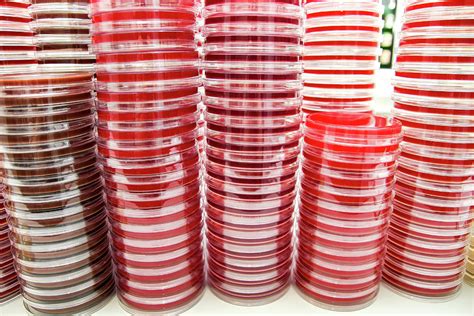 Agar Plates Photograph by Daniela Beckmann / Science Photo Library - Pixels