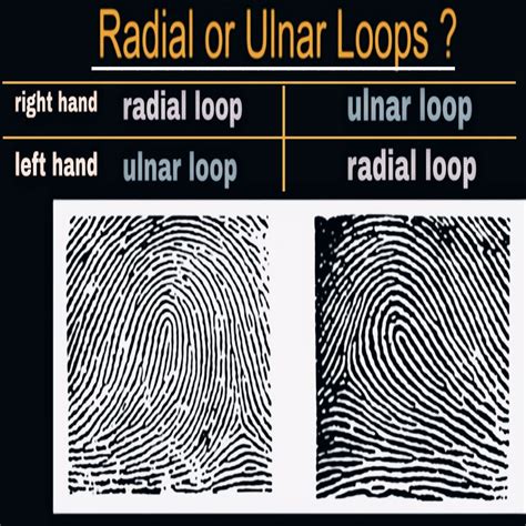 Fingerprint Analysis: Ulnar Loop or Radial Loop