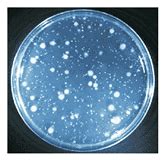 Heterotrophic bacteria - Sound Microbiology Lab testing & analysis