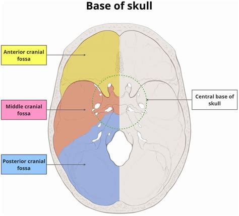 Arachnoid cyst causes, symptoms, diagnosis, prognosis and treatment