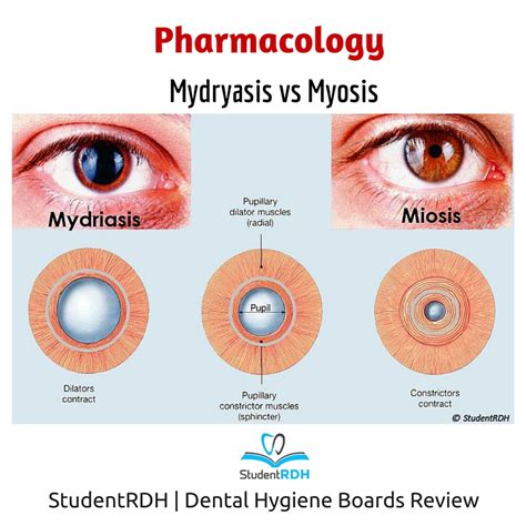 Miosis Y Midriasis