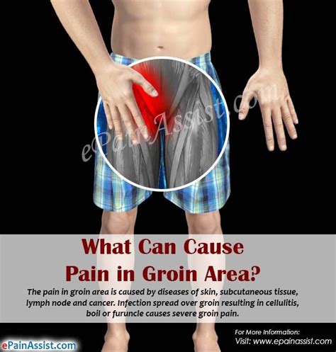 36 best Pelvic Pain images on Pinterest | Factors, Medical and Investigations