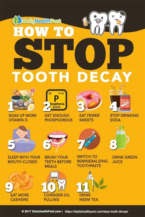 How to Stop Tooth Decay with These 11 Tooth-Healthy Habits #dailyhealthpost | Tooth decay, Cure ...