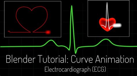 Ecg Animation