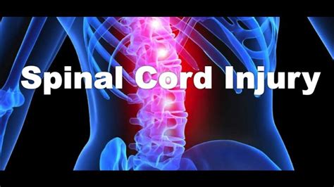 Spinal Cord Injury - Symptoms And Causes