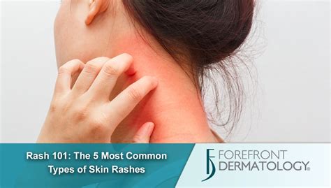 Rash 101: The 5 Most Common Types of Skin Rashes - Forefront Dermatology