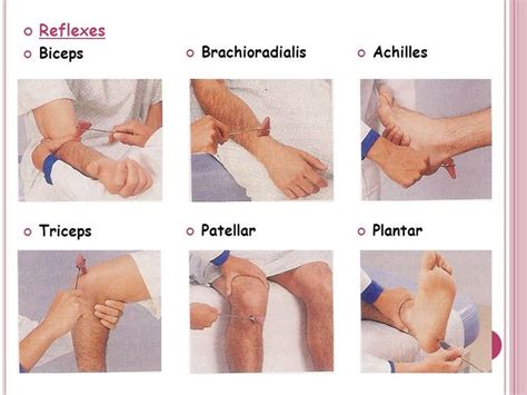 Biceps, Triceps, and Brachioradialis Reflex