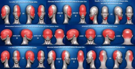 Headache Chart, Location, and Symptoms For Headaches Types