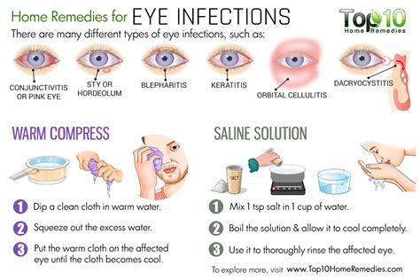 Home Remedies for Eye Infections