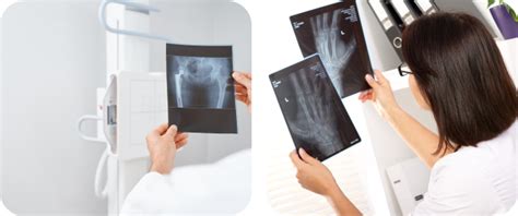 X-Ray and OPG – Advicon Imaging: Radiology in Sydney- Hornsby & Gladesville