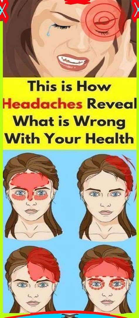 ednpoliticar82 in 2021 | Natural headache remedies, Headache, Headache ...