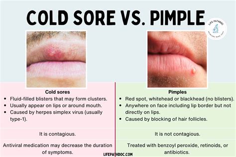 Cold Sore vs. Pimple: Pictures and Differences