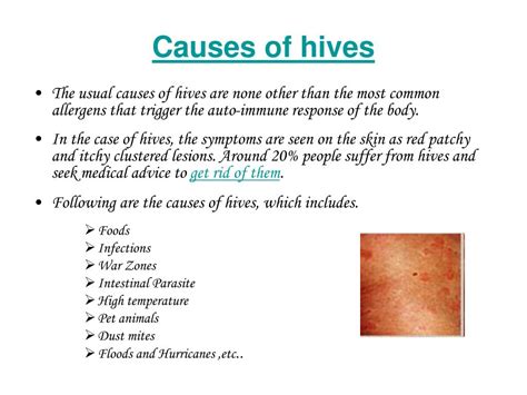 Hives Urticaria Causes Facts Types Symptoms