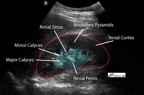 Normal Kidney Ultrasound