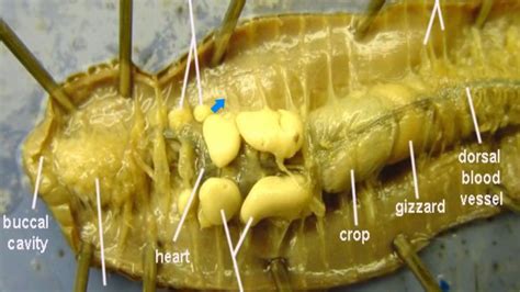 Tech Aid: Labeled Worm Diagram