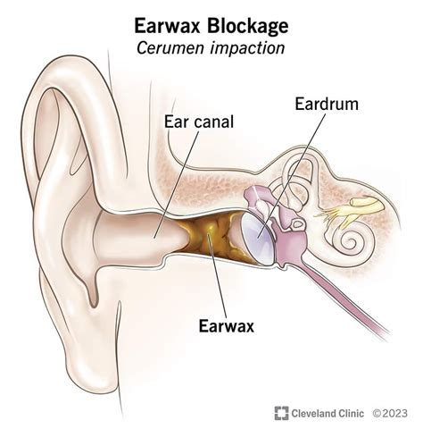 The Anatomy Of Ear Wax