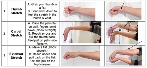 Carpal Tunnel Syndrome: 3 Great Exercises!