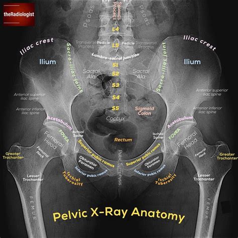 👨🏽‍💻Want to learn a system for reviewing a pelvic X-ray? Read on to find out and swipe left to ...