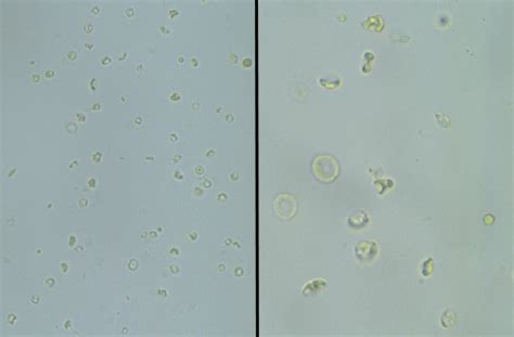 Urinalysis