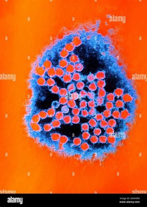 False-colour transmission electron micrograph of a group of rhinoviruses. The rhinovirus is one ...