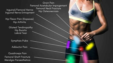 Understanding Hip Pain: A Location Diagram Guide - Military and Veteran