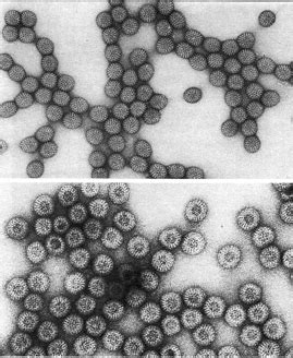 Negative Staining Electron Microscopy - Protocols/Techniques - Services - Electron Microscope ...