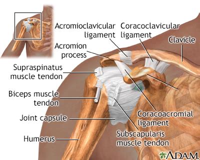 Shoulder pain Information | Mount Sinai - New York