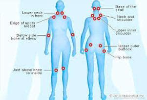 Fibromyalgia - Chest Pain Differentiation