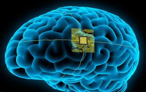 What is Neuralink Brain Chip?