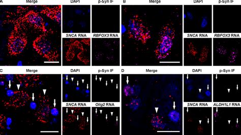 Representative images of RNAscope combined with immunofluorescence in... | Download Scientific ...