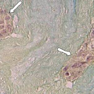 A microscopic view of the 20th culture day in which differentiation of ...