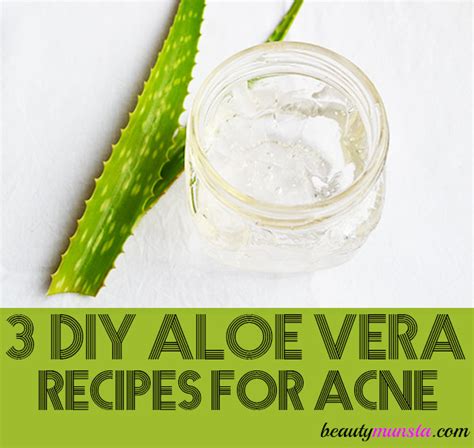 3 DIY Aloe Vera Recipes for Acne Prone Skin - beautymunsta