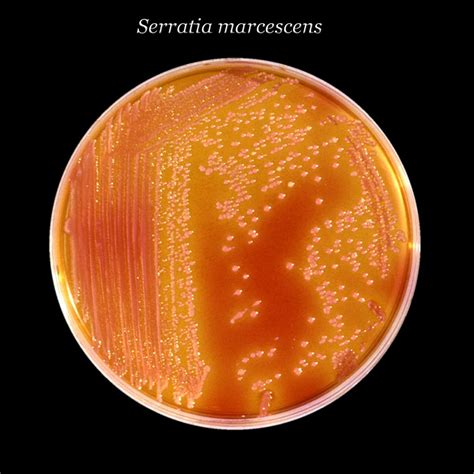 Serratia marcescens - Quip Labs