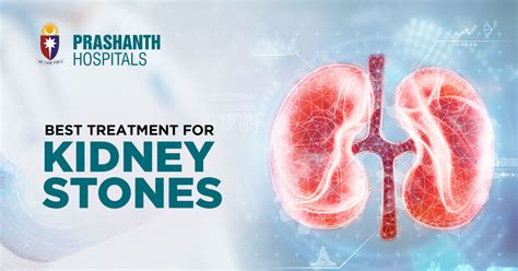 What is the best treatment for kidney stones?