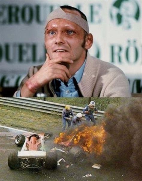 Niki Lauda. Former Formula One racer. In the 1976 German Grand Prix his car exploded and he ...