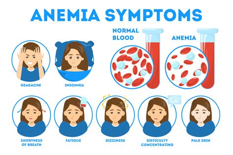 Anemia in Children: Types, Causes & Treatment by Dr. Stalin Ramprakash ...